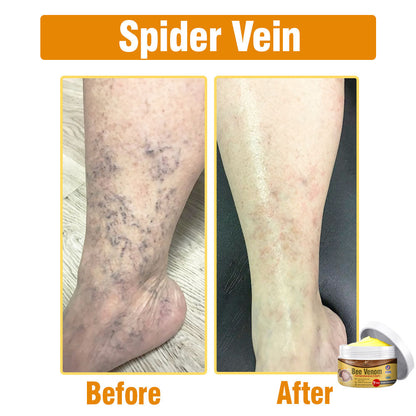 🐝 flysmus® Bee Venom Comprehensive Cream 🇺🇸 Made in USA