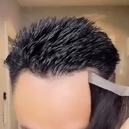 Sugoola® GhostLine Invisible Secret Frontal Hairline System 🇺🇸 100% Natural, Reliable for High Forehead