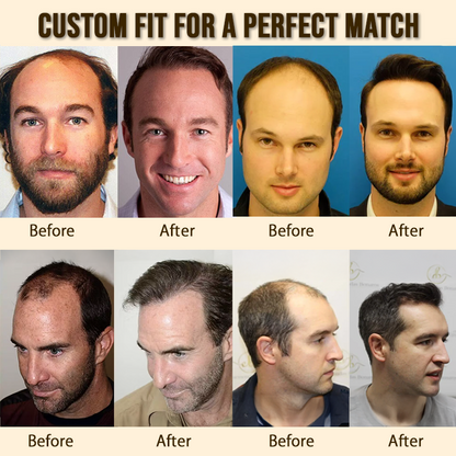 Sugoola® GhostLine Invisible Secret Frontal Hairline System 🇺🇸 100% Natural, Reliable for High Forehead