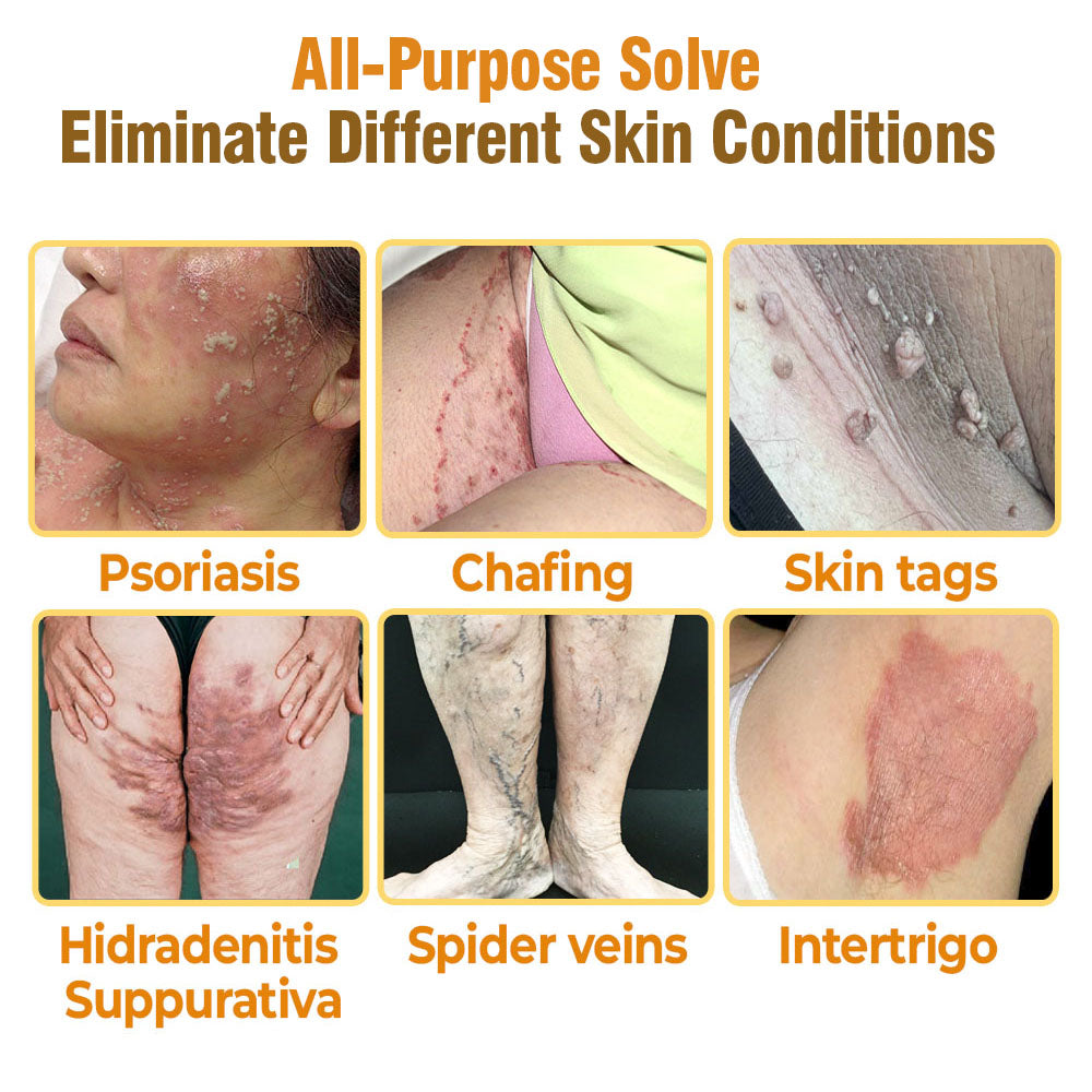 🐝 flysmus® Bee Venom Comprehensive Cream 🇺🇸 Made in USA