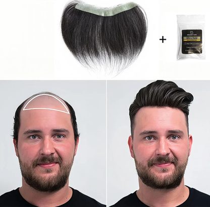 Sugoola® GhostLine Invisible Secret Frontal Hairline System 🇺🇸 100% Natural, Reliable for High Forehead