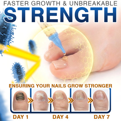 🇺🇸 CareBreeze® Fungi Free Bee Venom Nail Treatment 🥼🩺