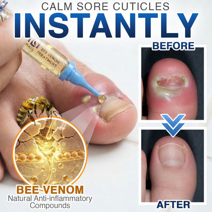 🇺🇸 CareBreeze® Fungi Free Bee Venom Nail Treatment 👨‍⚕️✨