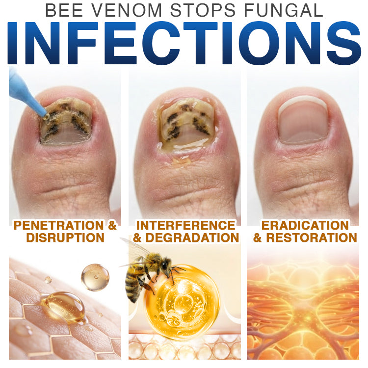 🇺🇸 CareBreeze® Fungi Free Bee Venom Nail Treatment 🥼🩺