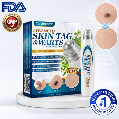 🇺🇸 CareBreeze® Advanced Skin Tag & Wart Removal Roller 🏆