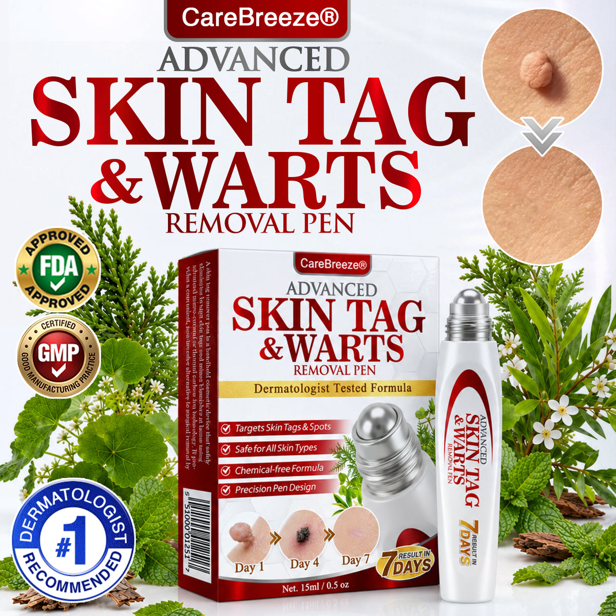 🇺🇸 CareBreeze® Herbal Skin Tag & Wart Removal Roller 🧑🏼‍⚕️