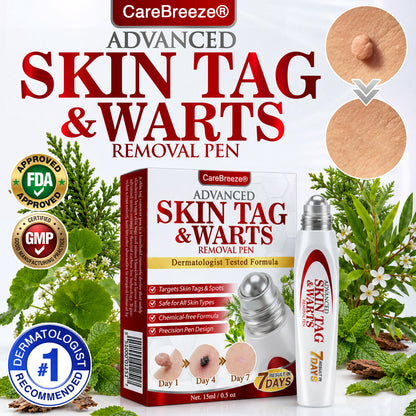 🇺🇸 CareBreeze® Herbal Skin Tag & Wart Removal Roller 🧑🏼‍⚕️