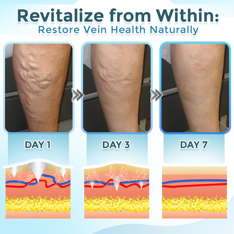 GFOUK® VenaRestore MicroNeedle Vein Repair Patch 🇺🇸