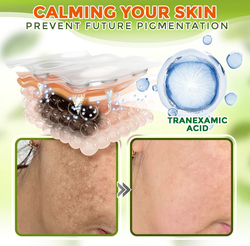 GFOUK® Comprehensive Microneedle Patch 🇺🇸
