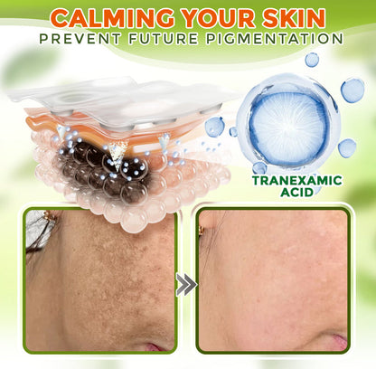GFOUK® Comprehensive Microneedle Patch 🇺🇸