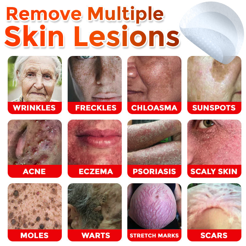 🇺🇸👩‍⚕️ GFOUK® MicroNeedle Botanic Skin Tag Removal Patch 🇺🇸 Made in the USA