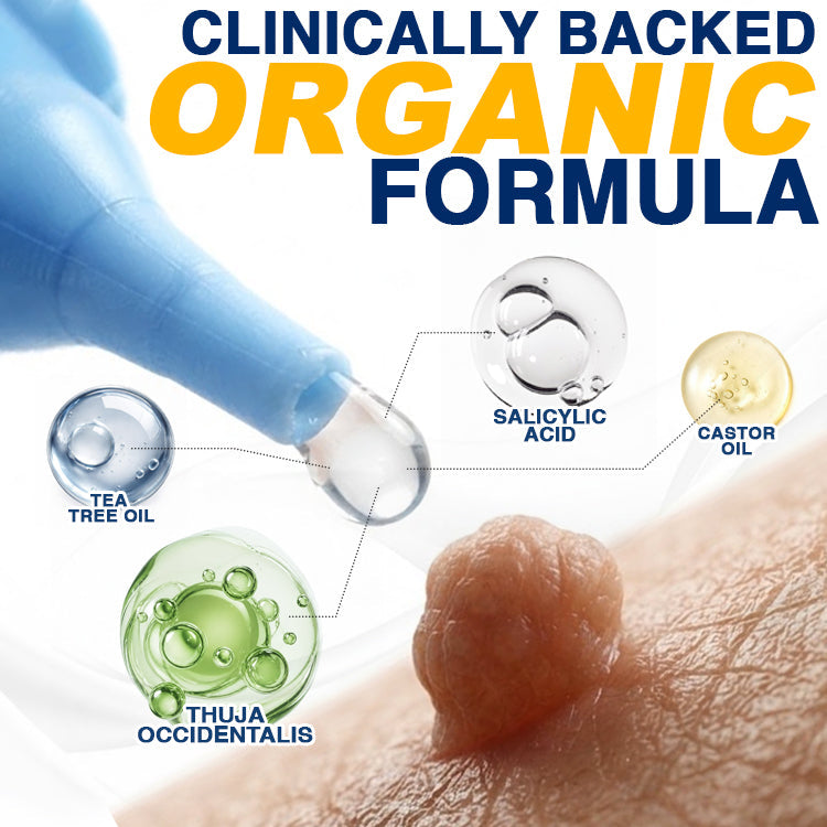 🇺🇸 CareBreeze® Skin Tag Removal Precision Gel 🥼