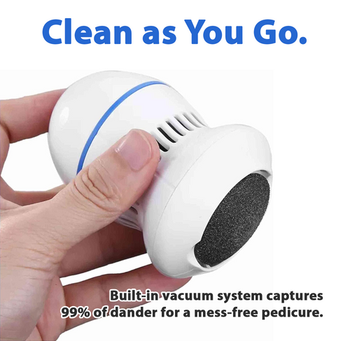 Remifa® Vacuum Callus Remover