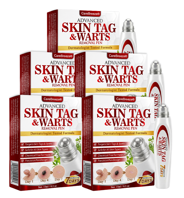🇺🇸 CareBreeze® Herbal Skin Tag & Wart Removal Roller 🧑🏼‍⚕️