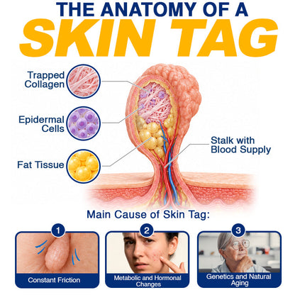 🇺🇸 CareBreeze® Skin Tag Removal Precision Gel 🥼