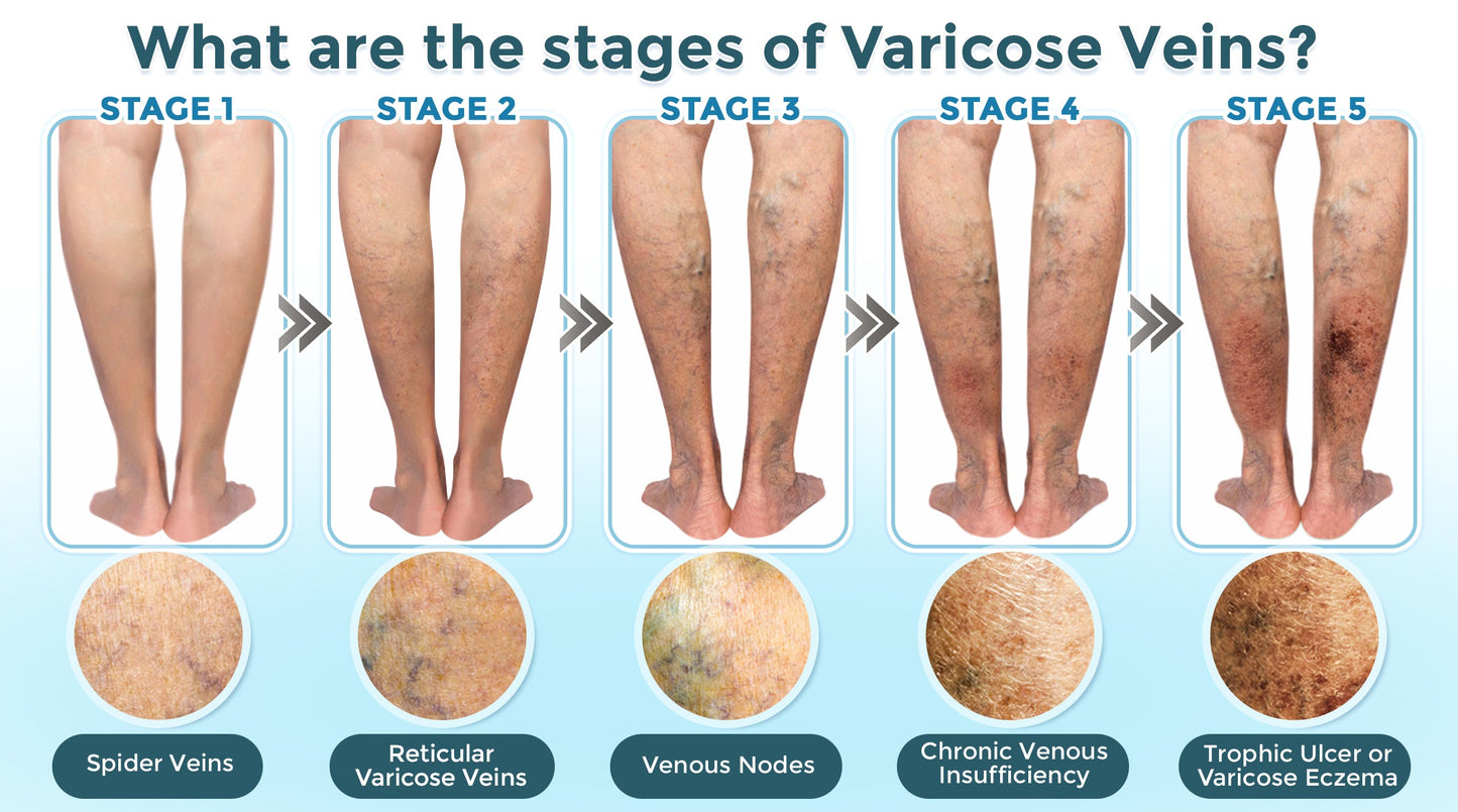 GFOUK® VenaRestore MicroNeedle Vein Repair Patch 🇺🇸